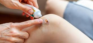 Antiseptic Healing Creams Nappy rash, minor wounds